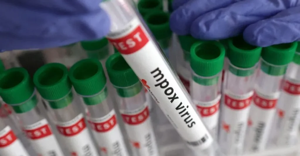 Suspected MPox case reported in Thiruvananthapuram; sample sent for testing | Kerala News | ACTPnews