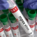 Suspected MPox case reported in Thiruvananthapuram; sample sent for testing | Kerala News | ACTPnews