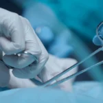 Kochi man’s thumb bitten off while saving daughter-in-law from chain-snatcher | Kerala News in English | ACTPnews
